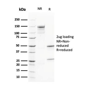 SDS-PAGE analysis of purified, BSA-free CALB2 antibody as confirmation of integrity and purity.