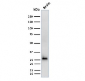 Western blot testing of human brain lysate with CALB2 antibody (clone CALB2/2602). Expected molecular weight ~29 kDa.