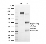 SDS-PAGE analysis of purified, BSA-free Calpain antibody (clone CAPN1/1530) as confirmation of integrity and purity.