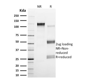 SDS-PAGE analysis of purified, BSA-free Calpain antibody (clone CAPN1/1530) as confirmation of integrity and purity.