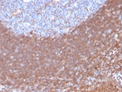 IHC staining of FFPE human tonsil with Calpastatin antibody (clone CAST/1550). HIER: boil tissue sections in pH 9 10mM Tris with 1mM EDTA for 20 min and allow to cool before testing.