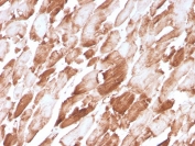 IHC staining of FFPE human cardiac muscle tissue with Actinin Alpha 2 antibody (clone ACTN2/3294). HIER: boil tissue sections in pH 9 10mM Tris with 1mM EDTA for 10-20 min and allow to cool before testing.