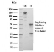 SDS-PAGE analysis of purified, BSA-free Actinin Alpha 2 antibody as confirmation of integrity and purity.