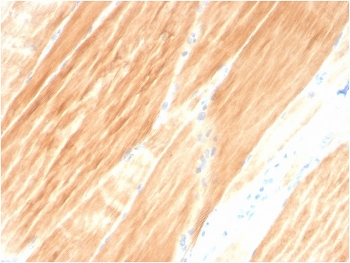 IHC staining of FFPE human skeletal muscle tissue with Actinin Alpha 2 antibody (clone ACTN2/3295). HIER: boil tissue sections in pH 9 10mM Tris with 1mM EDTA for 10-20 min and allow to cool before testing.