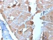 IHC staining of FFPE human cardiac muscle tissue with Actinin Alpha 2 antibody (clone ACTN2/3295). HIER: boil tissue sections in pH 9 10mM Tris with 1mM EDTA for 10-20 min and allow to cool before testing.
