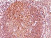 IHC staining of FFPE human tonsil with Bcl10 antibody (clone 151). HIER: boil tissue sections in pH 9 10mM Tris with 1mM EDTA for 20 min and allow to cool before testing.