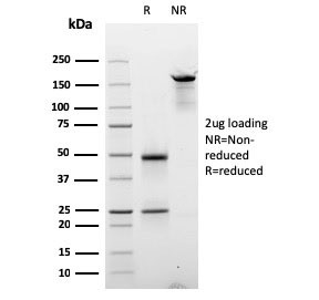 SDS-PAGE analysis of purified, BSA-free Cyclin E1 antibody (clone CCNE1/2587) as confirmation of integrity and purity.