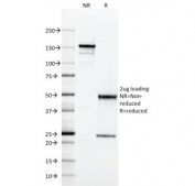 SDS-PAGE analysis of purified, BSA-free CD2 antibody (clone RPA-2.10) as confirmation of integrity and purity.