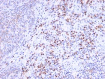 IHC staining of FFPE human tonsil tissue with EBAG9 antibody. HIER: boil tissue sections in pH 9 10mM Tris with 1mM EDTA for 20 min and allow to cool before testing.
