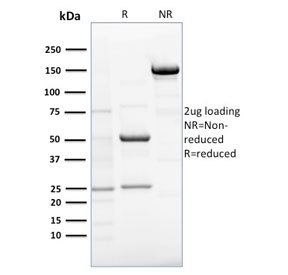 SDS-PAGE analysis of purified, BSA-free EBAG9 antibody as confirmation of integrity and purity.