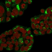 Immunofluorescent staining of permeabilized human MCF7 cells with EBAG9 antibody (clone CPTC-EBAG9-1, green) and Reddot nuclear stain (red).