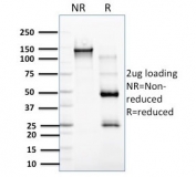 SDS-PAGE analysis of purified, BSA-free EBAG9 antibody as confirmation of integrity and purity.