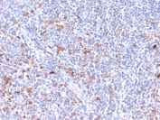 IHC staining of FFPE human tonsil tissue with EBAG9 antibody (clone CPTC-EBAG9-2). HIER: boil tissue sections in pH 9 10mM Tris with 1mM EDTA for 20 min and allow to cool before testing.