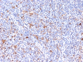 IHC staining of FFPE human tonsil tissue with EBAG9 antibody. HIER: boil tissue sections in pH 9 10mM Tris with 1mM EDTA for 20 min and allow to cool before testing.