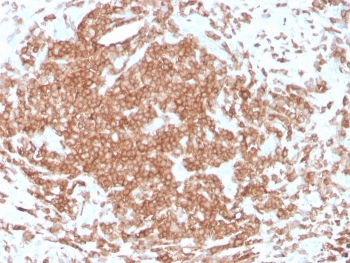 IHC staining of FFPE human tonsil with recombinant CD3e antibody (clone rC3e/1308). HIER: boil tissue sections in pH 9 10mM Tris with 1mM EDTA for 10-20 min and allow to cool before testing.~