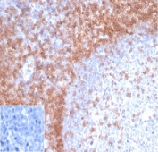 IHC staining of FFPE human tonsil with recombinant CD3e antibody (clone rC3e/1931). HIER: boil tissue sections in pH 9 10mM Tris with 1mM EDTA for 10-20 min and allow to cool before testing. Negative control inset: PBS used instead of primary antibody to control for secondary Ab binding.