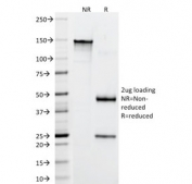 SDS-PAGE analysis of purified, BSA-free CD4 antibody (clone RIV7) as confirmation of integrity and purity.