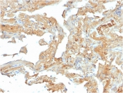 IHC staining of FFPE human lung with Fibronectin antibody (clone FN1/2950). HIER: boil tissue sections in pH 9 10mM Tris with 1mM EDTA for 20 min and allow to cool before testing.