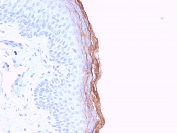 IHC staining of FFPE human skin with Kallikrein 5 antibody (clone KLK5/3841). HIER: boil tissue sections in pH6, 10mM citrate buffer, for 20 min and allow to cool before testing.