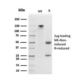 SDS-PAGE analysis of purified, BSA-free Kallikrein 5 antibody (clone KLK5/3841) as confirmation of integrity and purity.