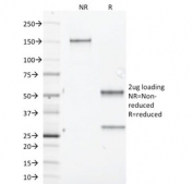 SDS-PAGE analysis of purified, BSA-free Aurora B antibody (clone AURKB/1845) as confirmation of integrity and purity.