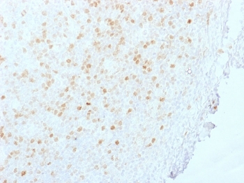 IHC staining of FFPE human tonsil with Aurora B antibody (clone AURKB/1845). HIER: boil tissue sections in pH 9 10mM Tris with 1mM EDTA for 20 min and allow to cool before testing.~