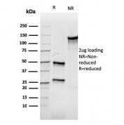 SDS-PAGE analysis of purified, BSA-free recombinant Aurora B antibody (clone rAURKB/1592) as confirmation of integrity and purity.