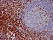 IHC staining of FFPE human lymph node with CD7 antibody (clone CD7/3737). HIER: boil tissue sections in pH 9 10mM Tris with 1mM EDTA for 20 min and allow to cool before testing.