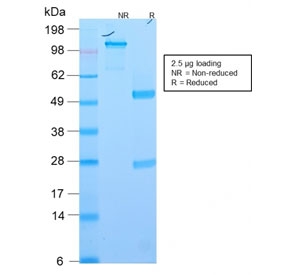 SDS-PAGE analysis of purified, BSA-free recombinant EpCAM antibody (clone EGP40/2571R) as confirmation of integrity and purity.