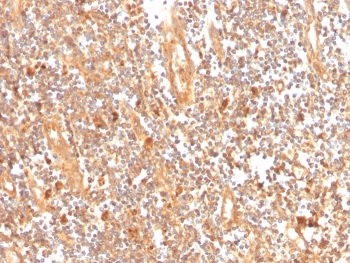 IHC staining of FFPE human tonsil with GCLM antibody. HIER: boil tissue sections in pH 9 10mM Tris with 1mM EDTA for 20 min and allow to cool before testing.