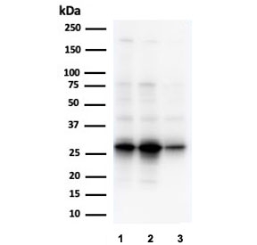 Western blot testing of human 1) A549, 2) A431 and 3) HepG2 cell lysate with GCLM antibody. Expected molecular weight ~31 kDa.