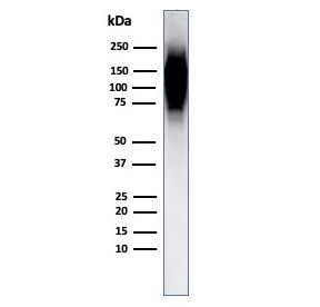 Western blot testing of human spleen lysate with HIF1 alpha antibody (clone Ha111a).