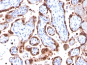IHC staining of FFPE human placenta with HIF1 alpha antibody (clone Ha111a). HIER: boil tissue sections in pH 9 10mM Tris with 1mM EDTA for 20 min and allow to cool before testing.