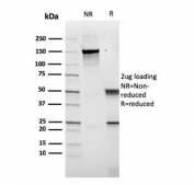 SDS-PAGE analysis of purified, BSA-free recombinant CD14 antibody (clone rLPSR/2408) as confirmation of integrity and purity.