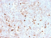 IHC staining of FFPE human spleen with recombinant CD14 antibody (clone rLPSR/2408). HIER: boil tissue sections in pH 9 10mM Tris with 1mM EDTA for 20 min and allow to cool before testing.