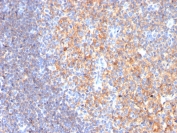 IHC staining of FFPE human tonsil with CD19 antibody (clone CD19/3116). HIER: boil tissue sections in pH 9 10mM Tris with 1mM EDTA for 10-20 min and allow to cool before testing.