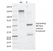 SDS-PAGE analysis of purified, BSA-free CD163 antibody (clone M130/2162) as confirmation of integrity and purity.