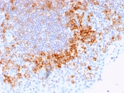 IHC staining of FFPE human tonsil with CD27 antibody (clone LPFS2/1611). HIER: boil tissue sections in pH 9 10mM Tris with 1mM EDTA for 20 min and allow to cool before testing.