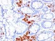 IHC staining of FFPE human colon with CD27 antibody (clone LPFS2/1611). HIER: boil tissue sections in pH 9 10mM Tris with 1mM EDTA for 20 min and allow to cool before testing.
