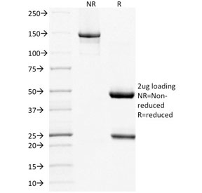 SDS-PAGE analysis of purified, BSA-free MUC16 antibody as confirma