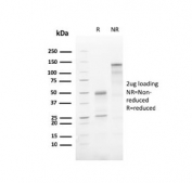 SDS-PAGE analysis of purified, BSA-free recombinant ATG5 antibody (clone AGT5/3220R) as confirmation of integrity and purity.