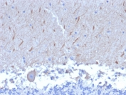 IHC staining of FFPE human brain with ATG5 antibody (clone ATG5/2553). HIER: boil tissue sections in pH 9 10mM Tris with 1mM EDTA for 10-20 min and allow to cool before testing.