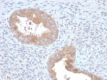 IHC staining of FFPE human uterus with ATG5 antibody. HIER: boil tissue sections in pH 9 10mM Tris with 1mM EDTA for 10-20 min and allow to cool before testing.