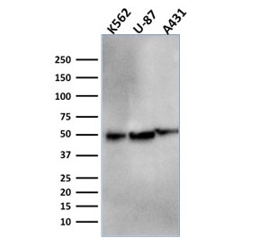 Western blot testing of human K562, U-87 and A431 cell lysate with ATG5 antibody. Predicted molecular weight ATG5: ~32 kDa; ATG5/ATG12 heterodimer: ~56 kDa.