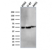 Western blot testing of human K562, U-87 and A431 cell lysate with ATG5 antibody (clone ATG5/2553). Predicted molecular weight ATG5: ~32 kDa; ATG5/ATG12 heterodimer: ~56 kDa.