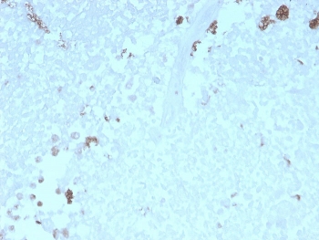 IHC staining of FFPE human uterus with recombinant ATG5 antibody. HIER: boil tissue sections in pH 9 10mM Tris with 1mM EDTA for 10-20 min and allow to cool before testing.~