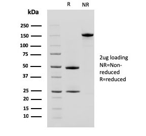 SDS-PAGE analysis of purified, BSA-free CD10 antibody (clone MME/2580) as confirmation of integrity and purity.