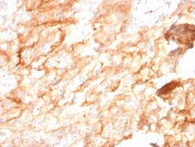 IHC staining of FFPE human kidney with CD10 antibody (clone MME/2590). HIER: boil tissue sections in pH 9 10mM Tris with 1mM EDTA for 20 min and allow to cool before testing.