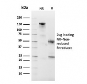 SDS-PAGE analysis of purified, BSA-free CD10 antibody (clone MME/2590) as confirmation of integrity and purity.