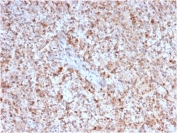 IHC testing of FFPE human spleen with CD40L antibody (clone CD40LG/2763). HIER: boil tissue sections in pH6, 10mM citrate buffer, for 10-20 min followed by cooling at RT for 20 min.
